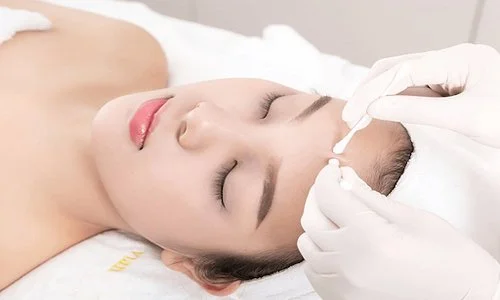 An toàn và tiện lợi hơn khi trị mụn tại spa Hà Nội